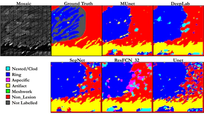 A Multiresolution Convolutional Neural Network with Partial Label Training for Annotating Reflectance Confocal Microscopy Images of Skin featured image